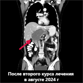 fuda14_125253.png image.png