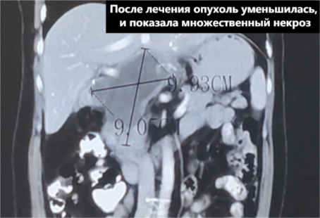 fuda14_863947.png image.png