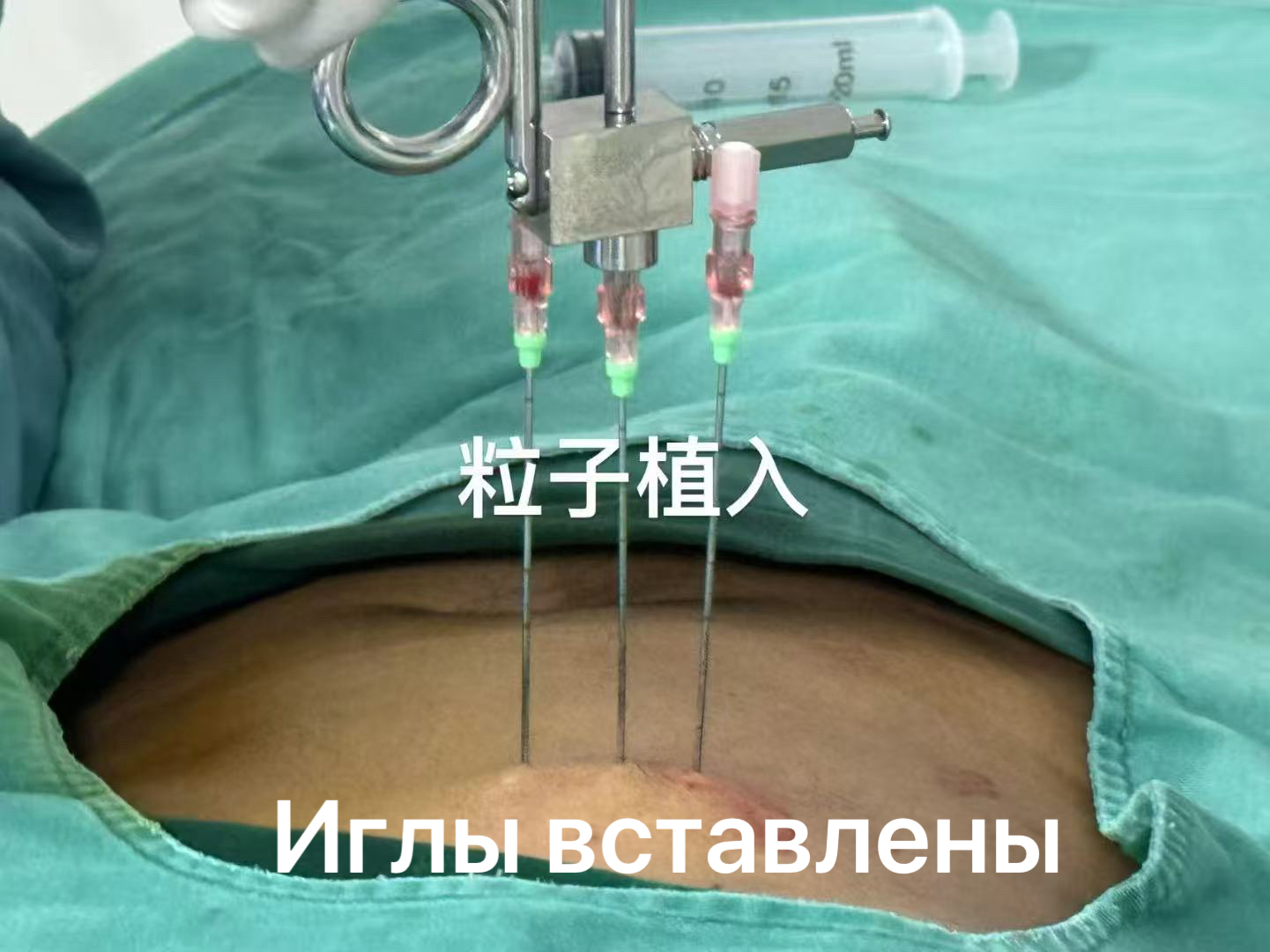 cfb4c9bba25b051a85dbd4dca5ad688.jpg