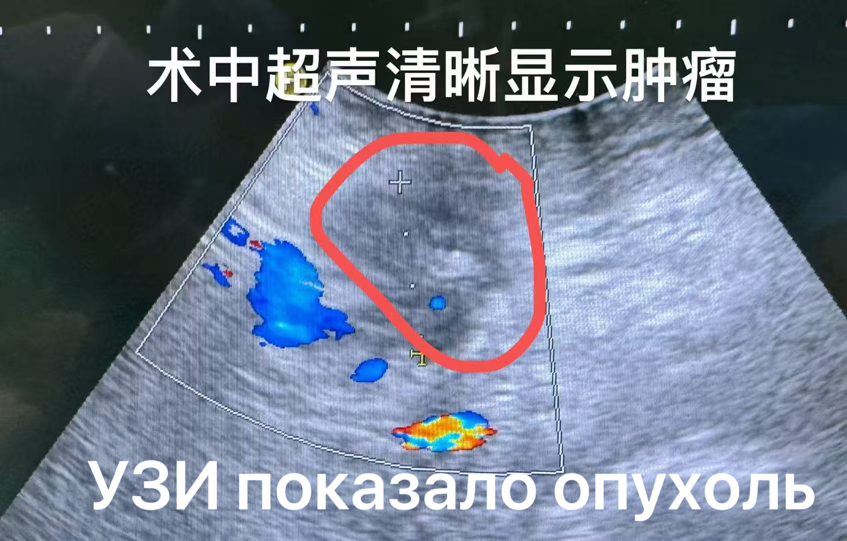 f8511a12df882dae96d47b7ec4ffc342_.jpg